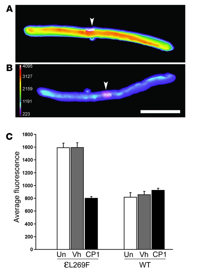 Calpain activity is elevated in transgenic SCS muscle fibers.
(A and B) ...