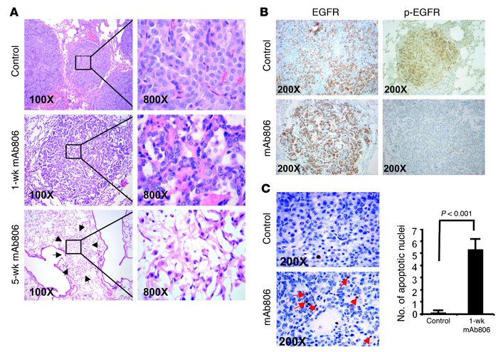 Histopathological features of EGFRvIII-driven lung adenocarcinomas in mi...