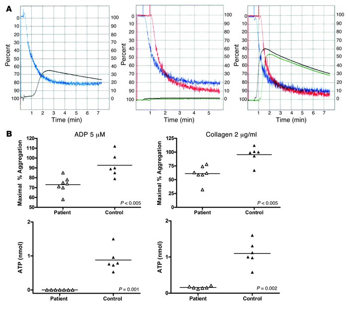Platelet aggregation and dense granule release.
(A) Representative measu...