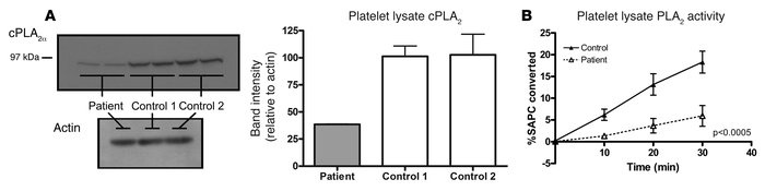 Platelet PLA2 quantity and activity.
   
(A) Western blot of platelet ly...