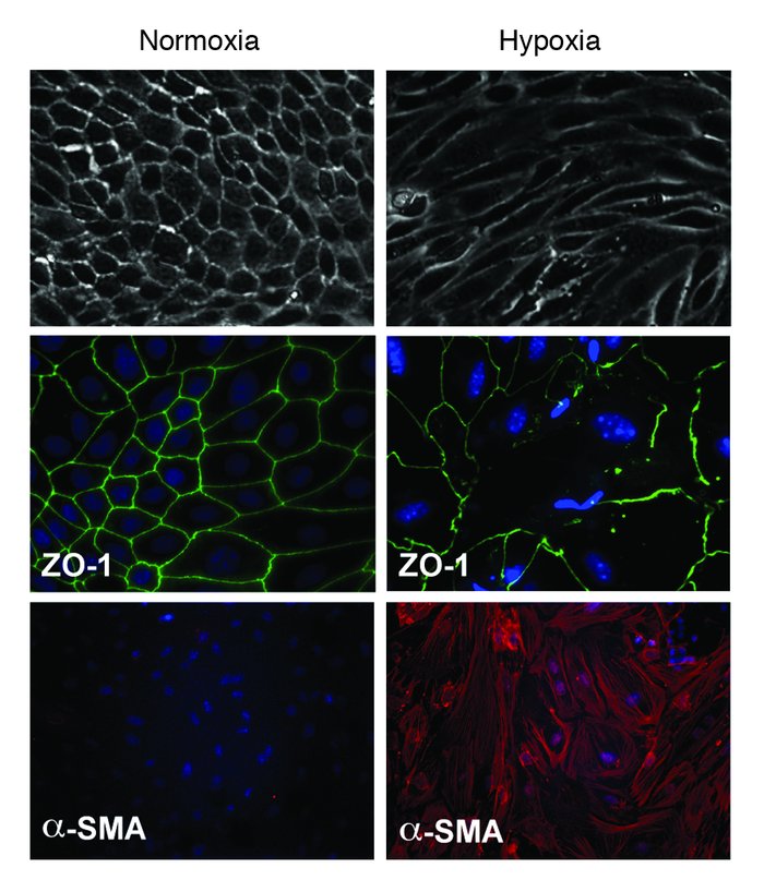 Hypoxia induces morphological and phenotypic changes in PTECs consistent...