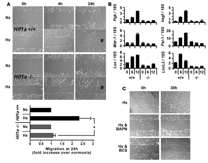 Hif-1 enhances epithelial cell migration through induction of lysyl oxid...