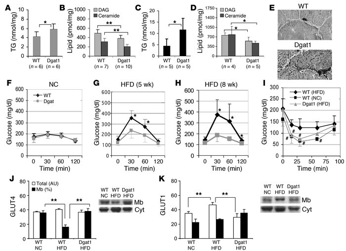 Myocellular DGAT1 overexpression reproduces the athlete’s paradox and pr...