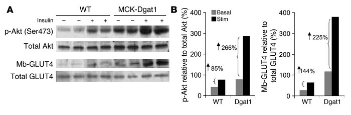 Insulin-induced Akt phosphorylation and GLUT4 membrane translocation in ...