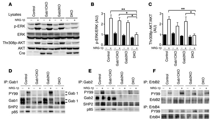 Gab1 and Gab2 are required for NRG-1β–dependent ERK and AKT activation i...