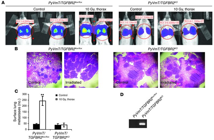 Absence of TGFβRII in tumor cells abrogates radiation-induced increase i...