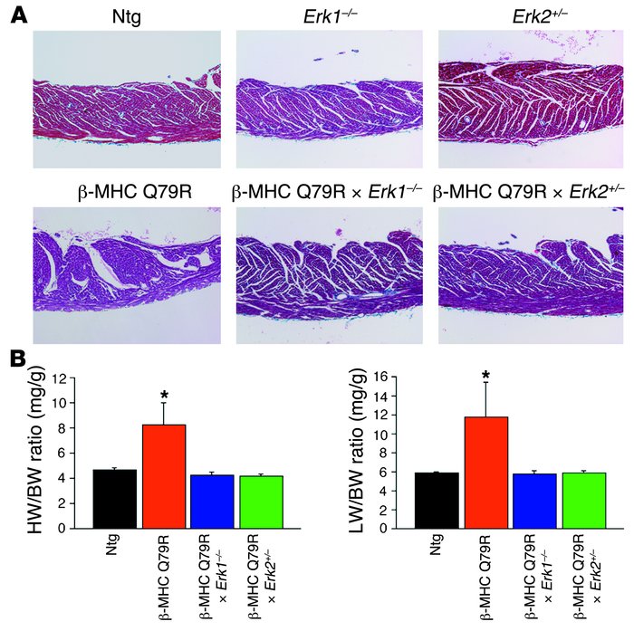 Analyses of adult hearts.
(A) Histology of 3-month-old hearts stained wi...