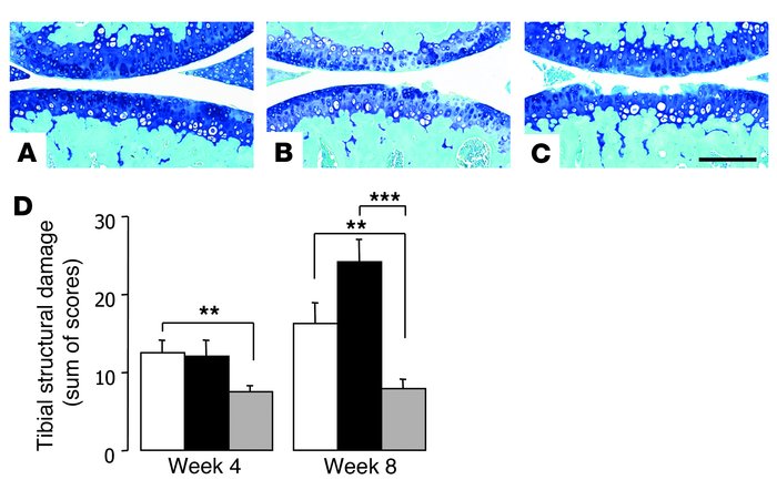 DMM model in wild-type and aggrecan knockin mice.
(A–C) Representative t...