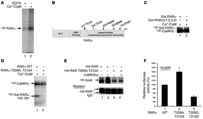 Phosphorylation of RARα by CaMKIIγ.
(A) In vitro–translated RARα was sub...