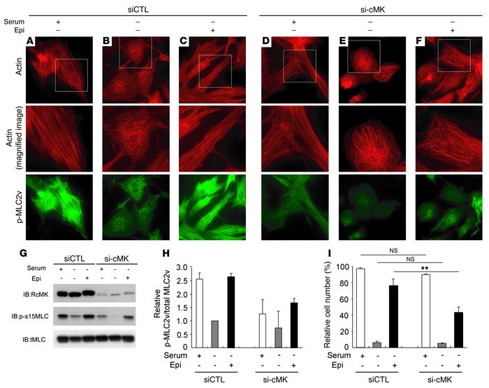 Cardiac-MLCK regulates the initiation of sarcomere assembly in cultured ...