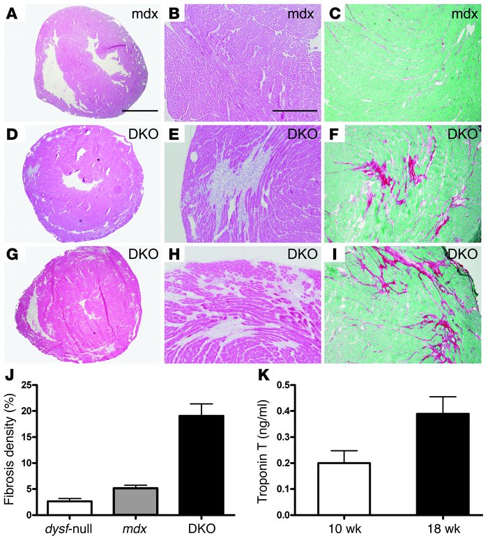 Severe early-onset cardiomyopathy in DKO mice.
Histological examination ...