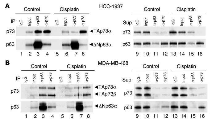 JCI - The p63/p73 network mediates chemosensitivity to cisplatin in a ...