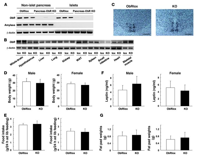 Evidence for deletion of ObR and physiological effects of pancreas-speci...