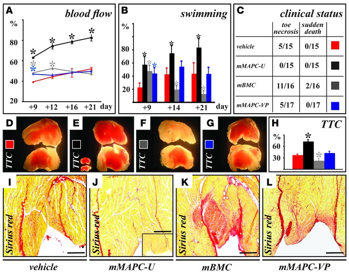 Late effects of mMAPC-U, mMAPC-VP, and mBMCs in moderate ischemia.
(A) L...