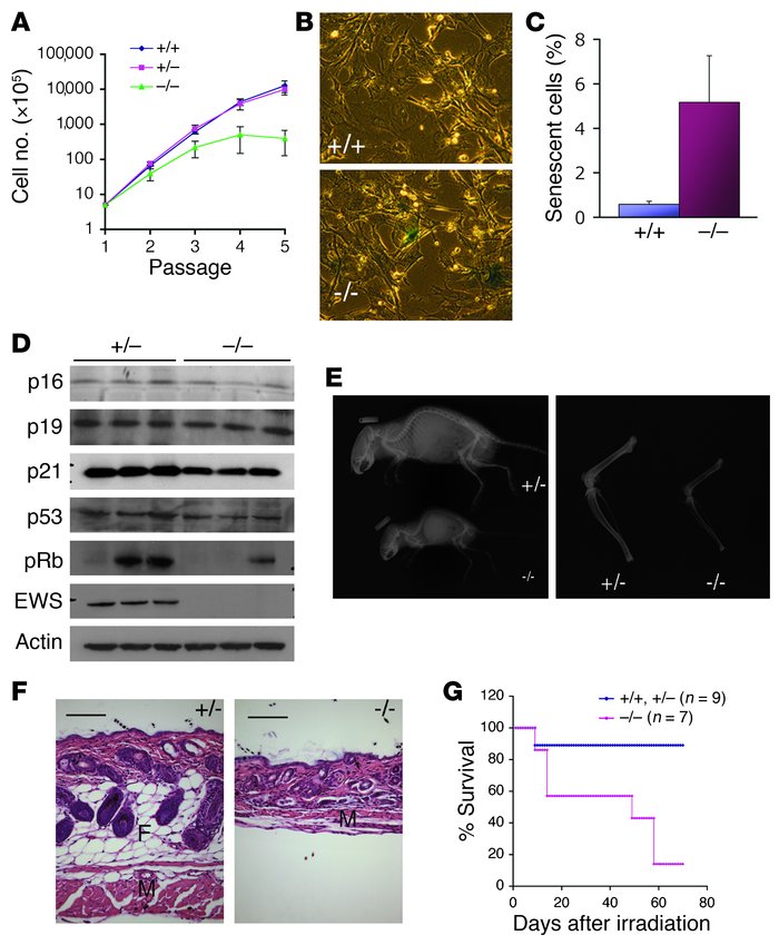 Premature cellular senescence and aging-like features in Ews–/– mice.
  ...