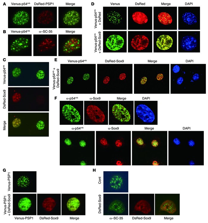 Importance of association of p54nrb with Sox9 in upregulation of Col2a1 ...