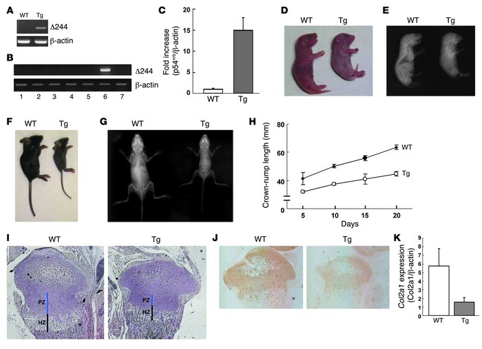 Impaired chondrogenesis in the transgenic mice expressing the p54nrb mut...