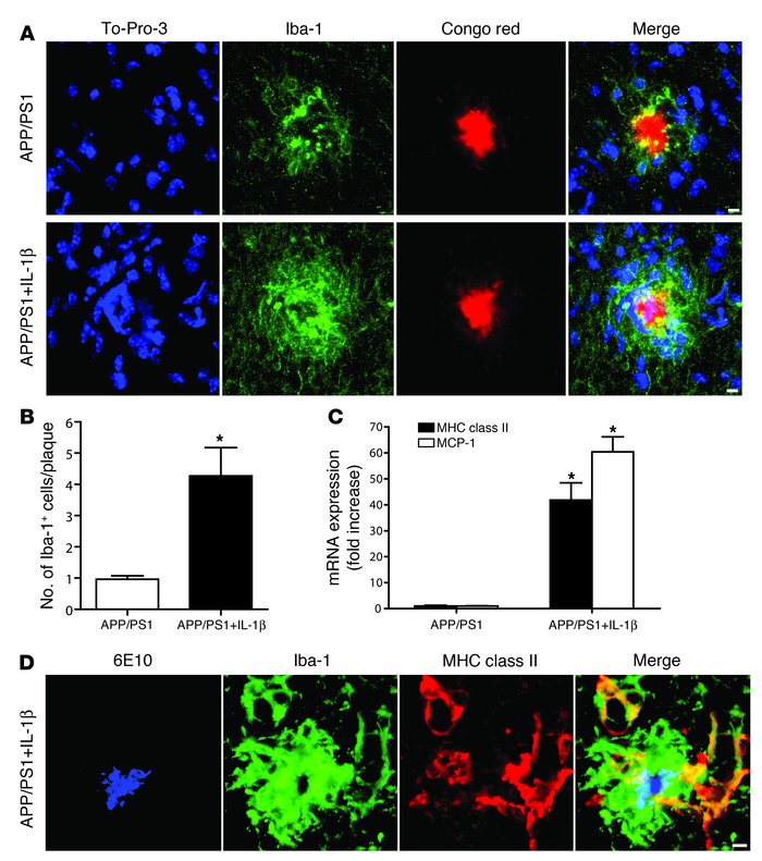 IL-1β driven microglial activation likely underlies reductions in plaque...