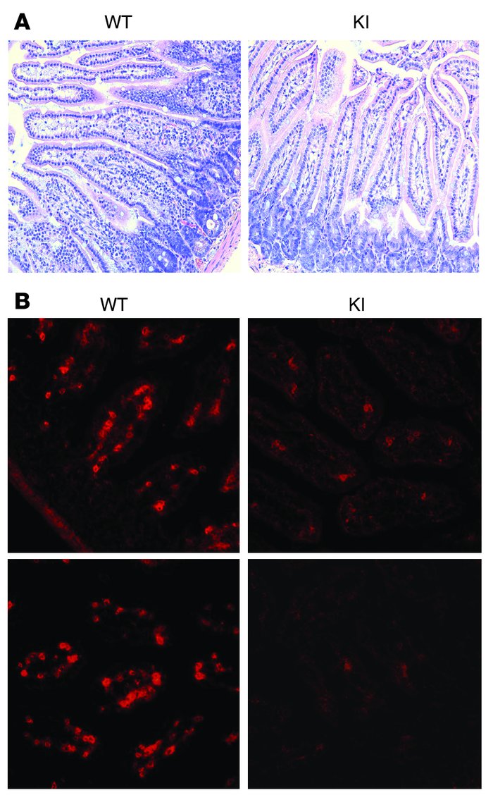 Histology showing reduced T cell numbers in the gut of β7 (D146A) mice.
...