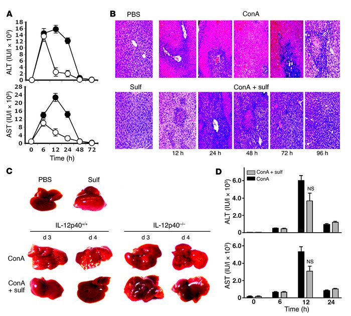 Sulfatide administration protects against ConA-induced hepatitis.
(A) AL...