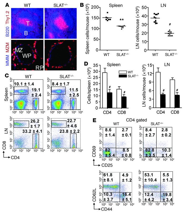 Phenotype of peripheral T cells in SLAT–/– mice.
               
(A) Spl...