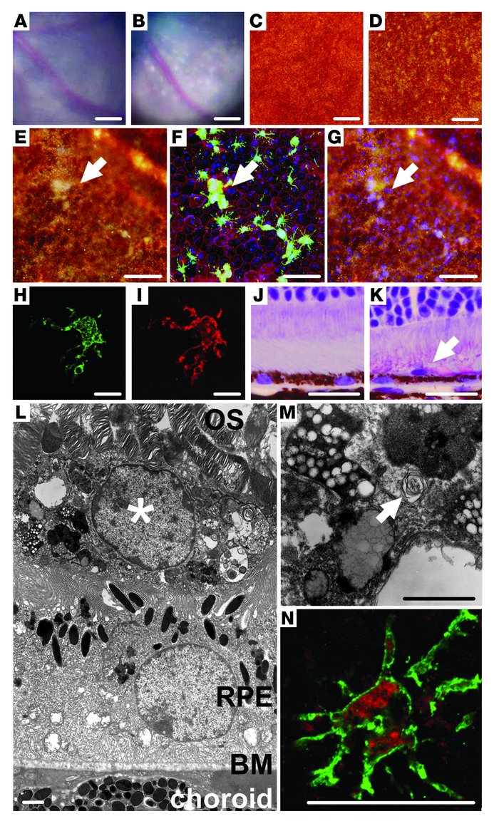 Drusen observed in CX3CR1 knockout animals are bloated SrMCs.
(A–D) Comp...