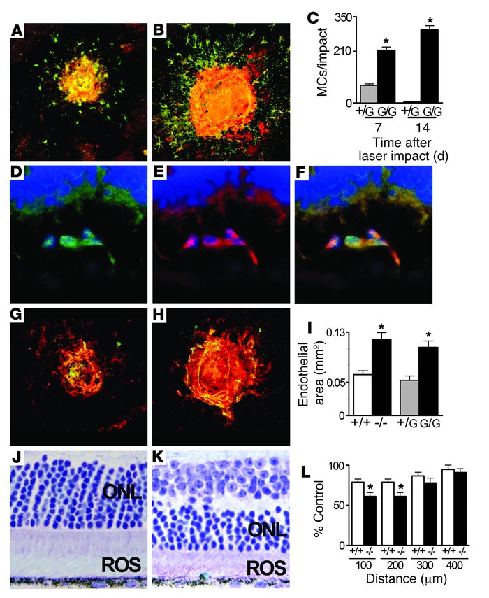 SrMCs accumulate after laser injury, exacerbate neovascularization, and ...