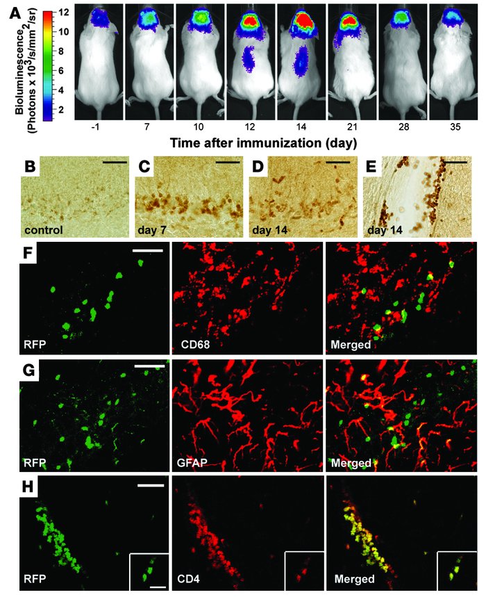 Early activation of TGF-β signaling in brains of SBE-luc (A) or SBE-lucR...