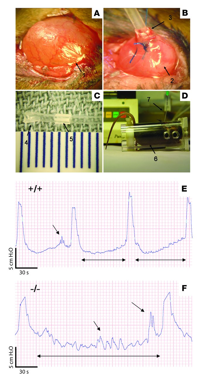 Materials and methods for cystometry.
(A) Bladder after minilaparotomy (...