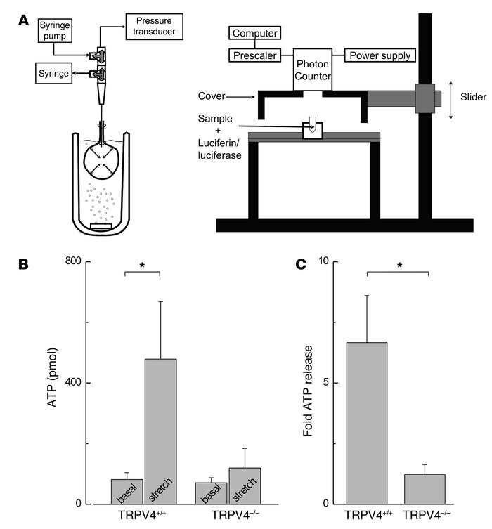 Stretch-induced intravesical ATP release in decentralized bladders from ...