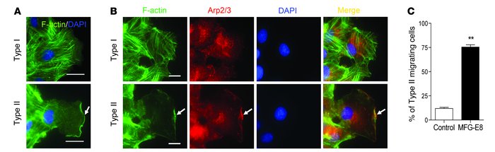 MFG-E8 treatment results in reorganization of F-actin and Arp2/3 in migr...