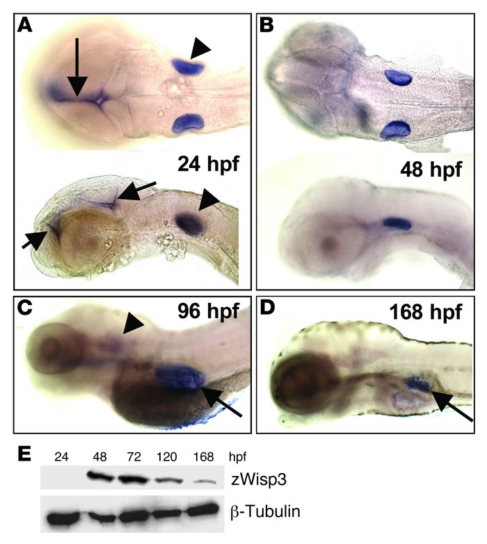 Expression of endogenous zWisp3.
(A–D) Whole-mount in situ hybridization...