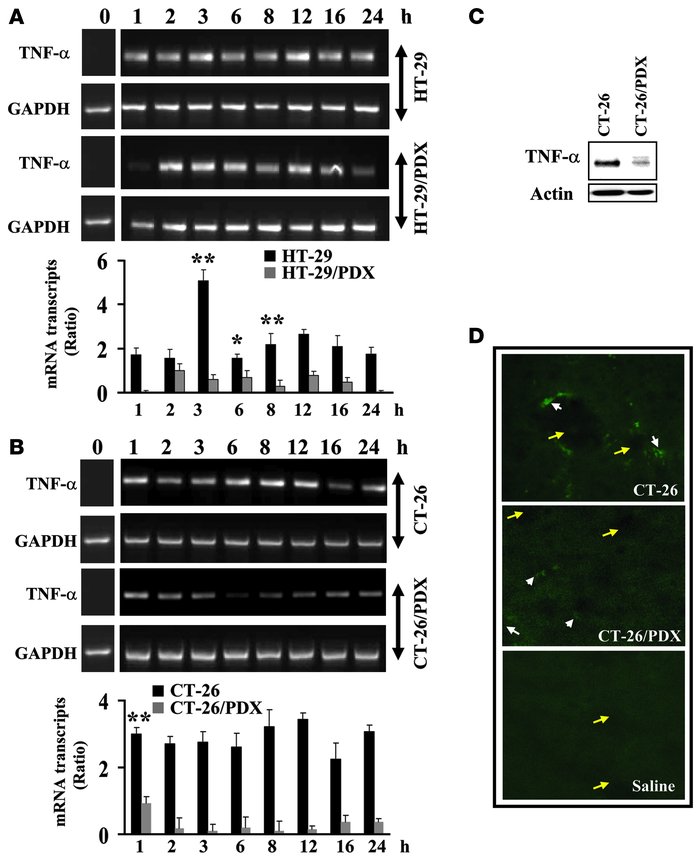 Induction of hepatic TNF-α mRNA by tumor cells.
(A and B) Mice were inje...