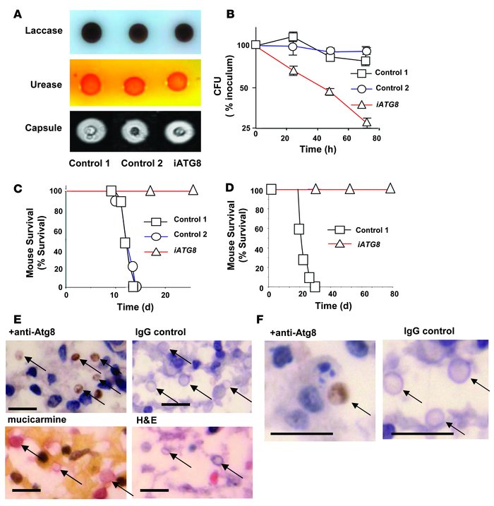 Role of ATG8 in murine and human cryptococcosis.
               
(A) Cn ...