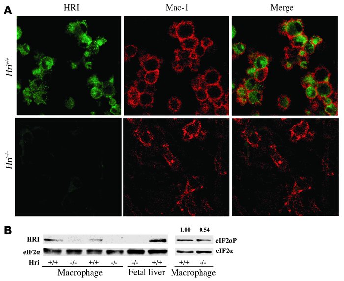 Expression of HRI protein in BMDMs.
(A) Immuno­fluorescence staining of ...