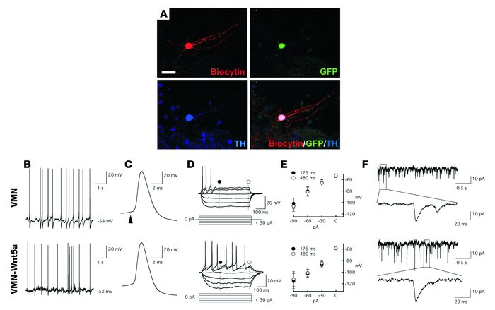 VMN-Wnt5a cells show the electrophysiological properties of midbrain DA ...