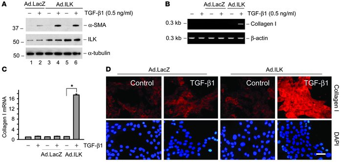 Ectopic expression of ILK mimics tPA and synergistically promotes myofib...