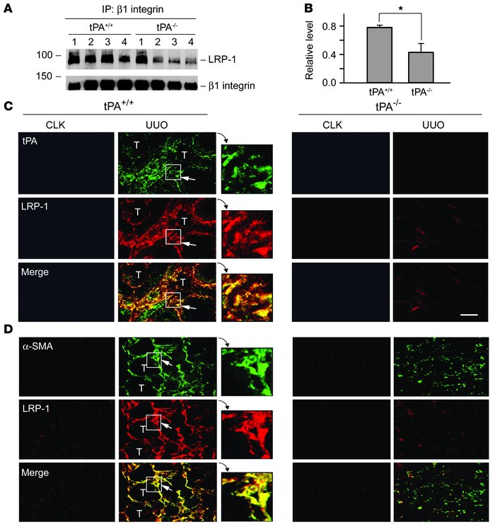 tPA promotes LRP-1/β1 integrin interaction and myofibroblast activation ...