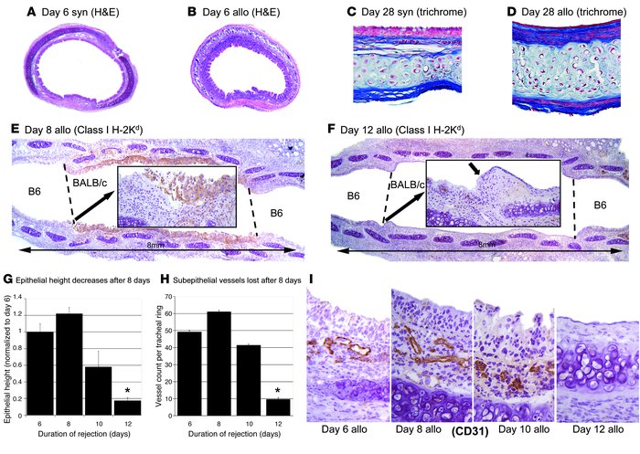 Loss of epithelium and subepithelial vessels after 8 days of acute rejec...