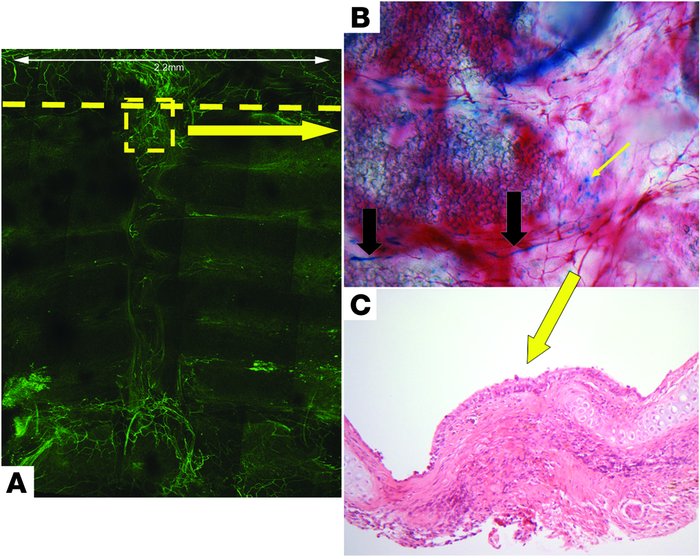 Neovascularization of membranous trachea by day 28 involves recipient-de...