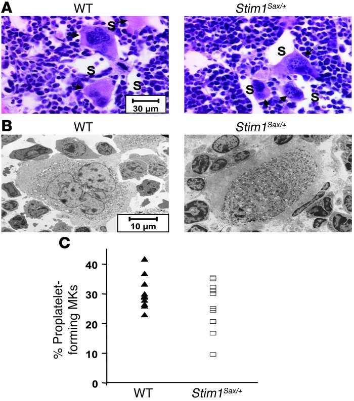 Normal MK differentiation and morphology in Stim1Sax/+ mice.
           ...