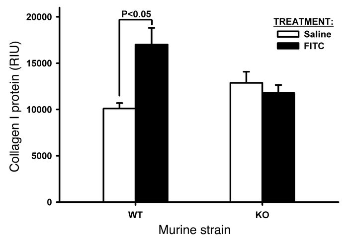 Effects of FITC on lung collagen.
WT and TERT–/– mice were treated as in...