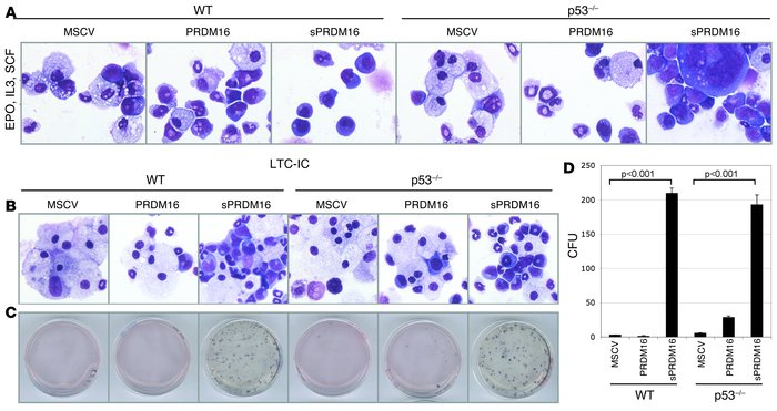 sPRDM16 overexpression in lin– cells grown in methylcellulose and in LTC...