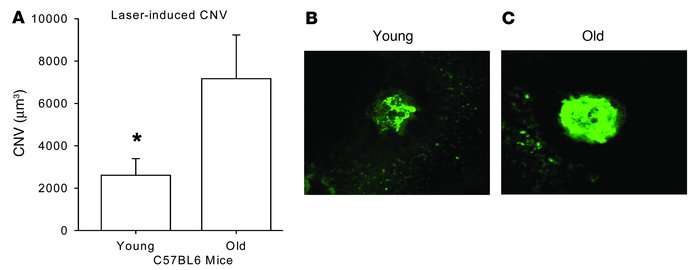 Quantification of CNV in young (<3 months of age) and old (>18 mon...