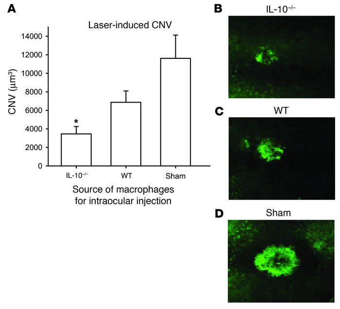 Assessment of CNV inhibition following intraocular injection of macropha...