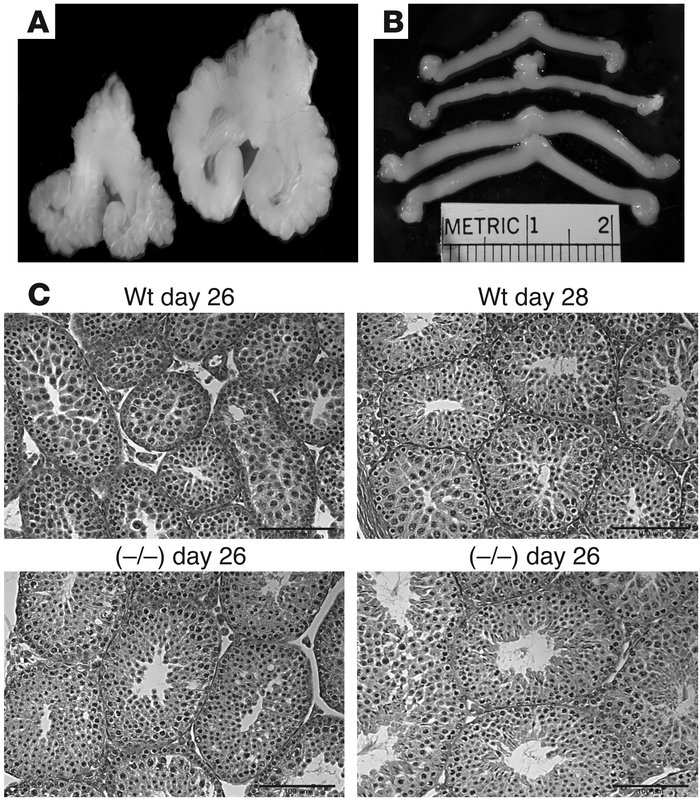 Comparison of seminal vesicles and uteri from WT and GalNAc-4-ST1–/– mic...