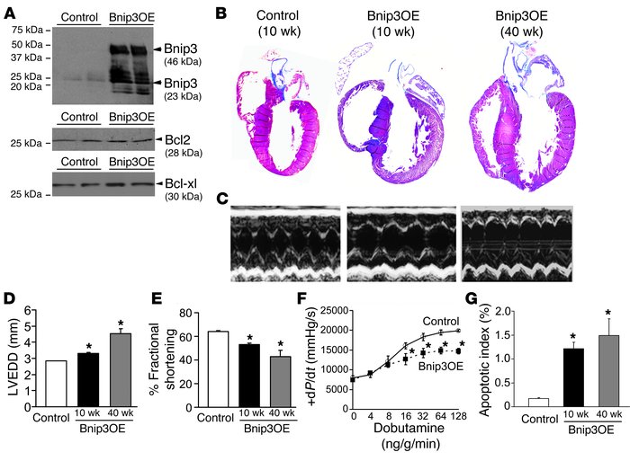Studies of cardiac Bnip3 overexpression from the neonatal period.
(A) Re...