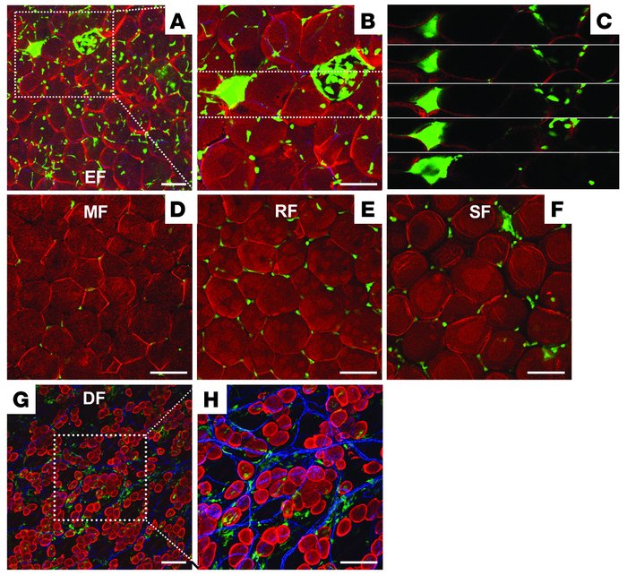 No GFP+perilipin+ adipocytes were detected in the adipose tissues of mic...