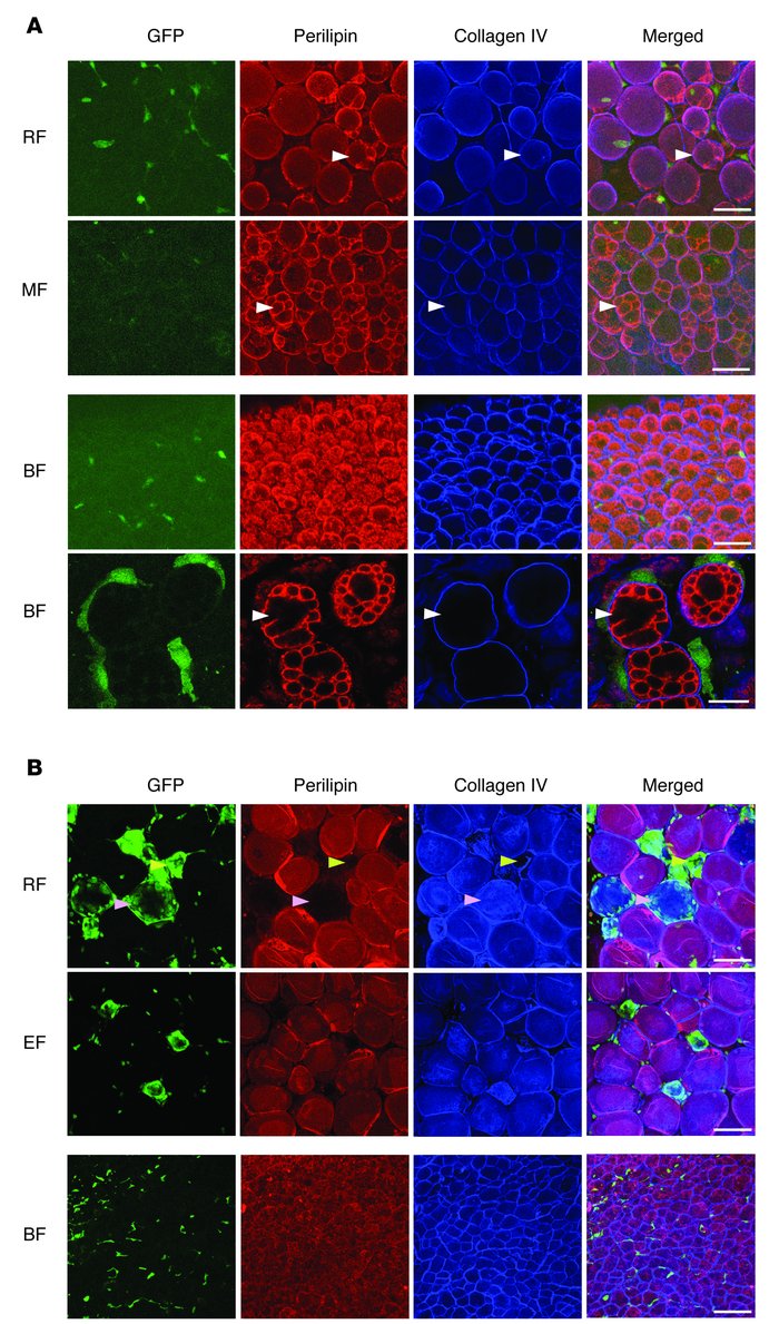 No GFP+perilipin+ unilocular and multilocular adipocytes were detected i...