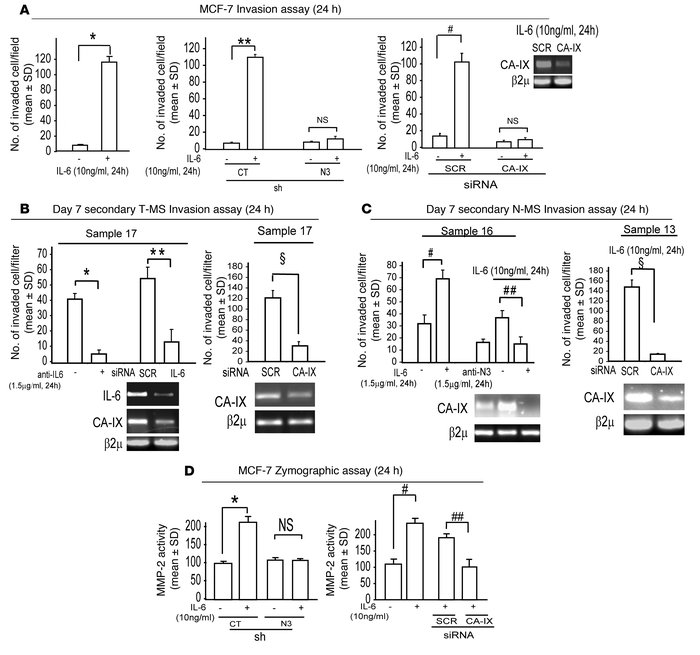 IL-6/Notch-3 cross-talk enhances the invasive potential of MS and MCF-7 ...